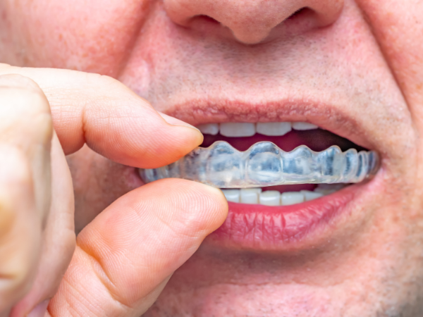 How Splint Therapy Helps Relieve Symptoms & Prevent Damage