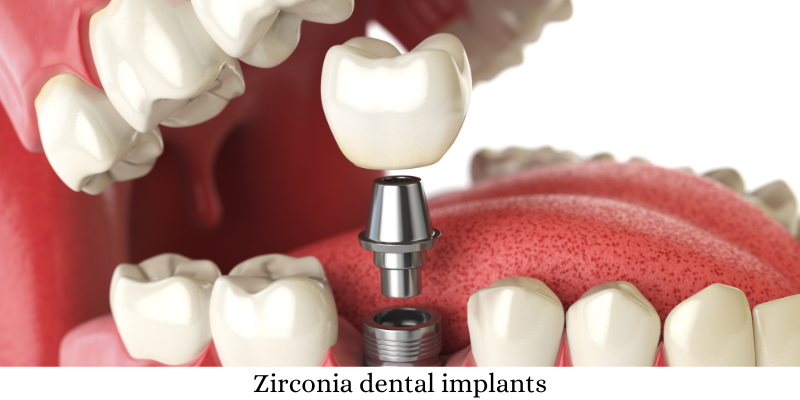Zirconia dental implants