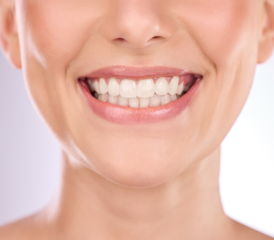 A Quick and Painless Smile Transformation