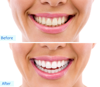 Aesthetic and Functional Benefits Beyond Beauty