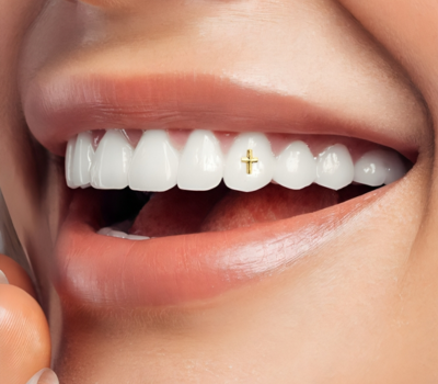 Tooth Jewellery Aftercare – Keep Your Sparkle Bright!​