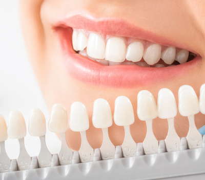 Whitening Treatment That Complements Your Lifestyle