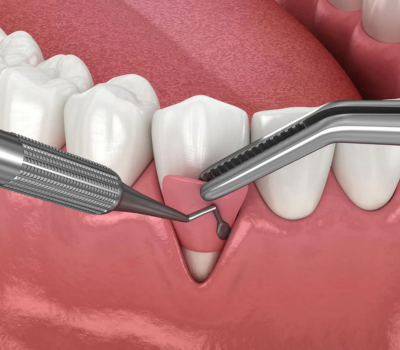 Effective Solutions for Lasting Relief