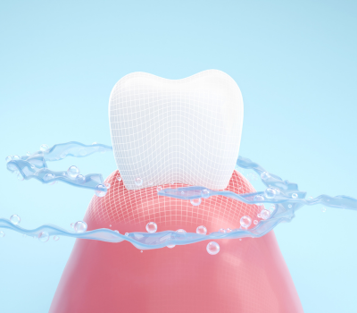 How Often Should You Get a Teeth Cleaning?​