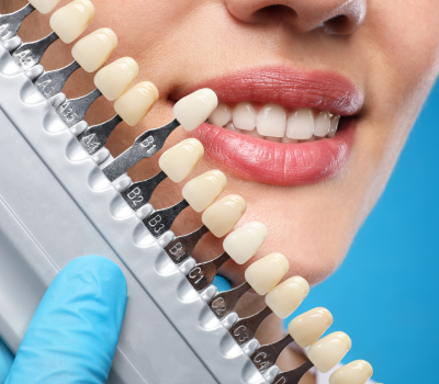 Enhancing Smile Aesthetics with Advanced Cosmetic Dentistry