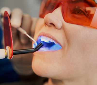 The Dental Filling Procedure: What to Expect