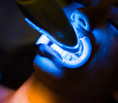 Effective Treatment Options for Missing Teeth
