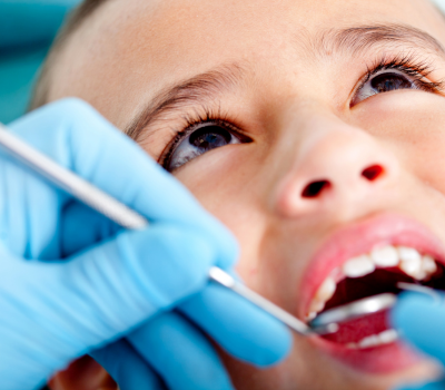 Preventive Care to Keep Cavities Away
