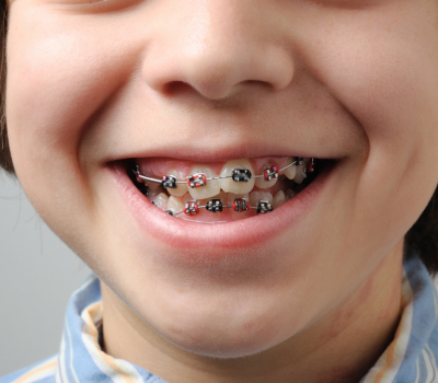 Gentle and Painless Treatments for Little Teeth