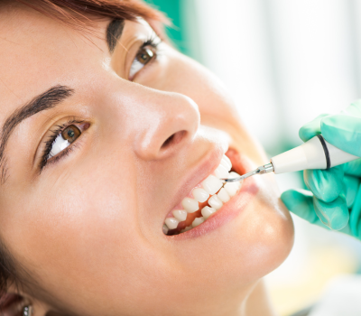 Who Should Get a Dental Cleaning? ​