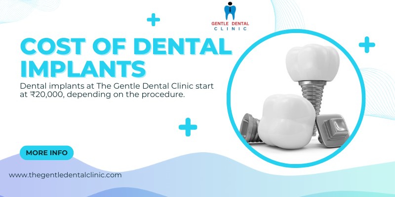 Cost of dental implants