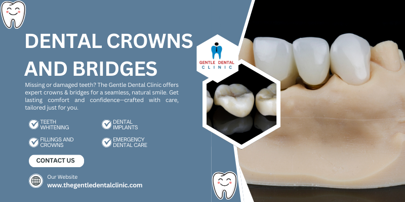 Dental crowns and bridges (1)