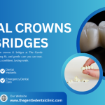 Dental crowns and bridges