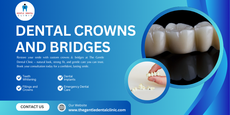 Dental crowns and bridges
