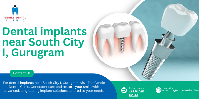 Dental implants near South City I, Gurugram