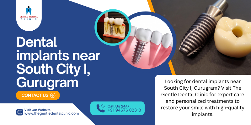 Dental implants near South City I, Gurugram