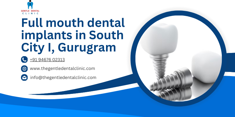 Full mouth dental implants in South City I, Gurugram