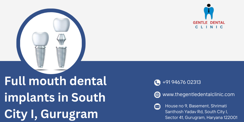 Full mouth dental implants in South City I, Gurugram