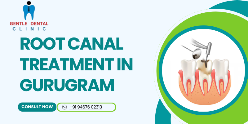 Root canal treatment in Gurugram