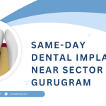 Same-day dental implants near Sector 41 Gurugram