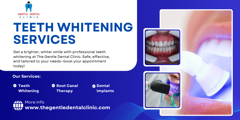 Teeth whitening services (1)