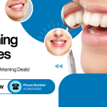 Teeth whitening services