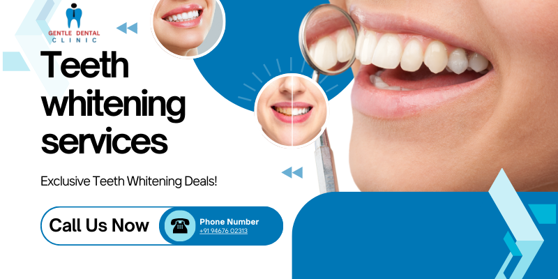 Teeth whitening services