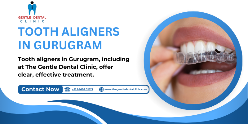 Tooth aligners in Gurugram