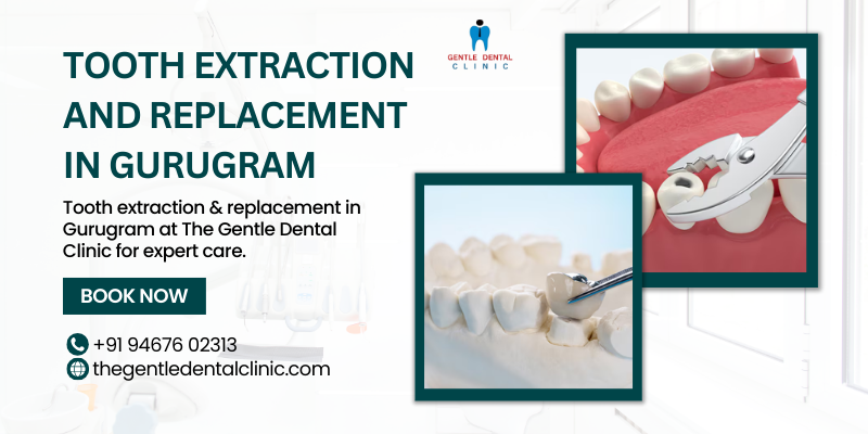 Tooth extraction and replacement in Gurugram